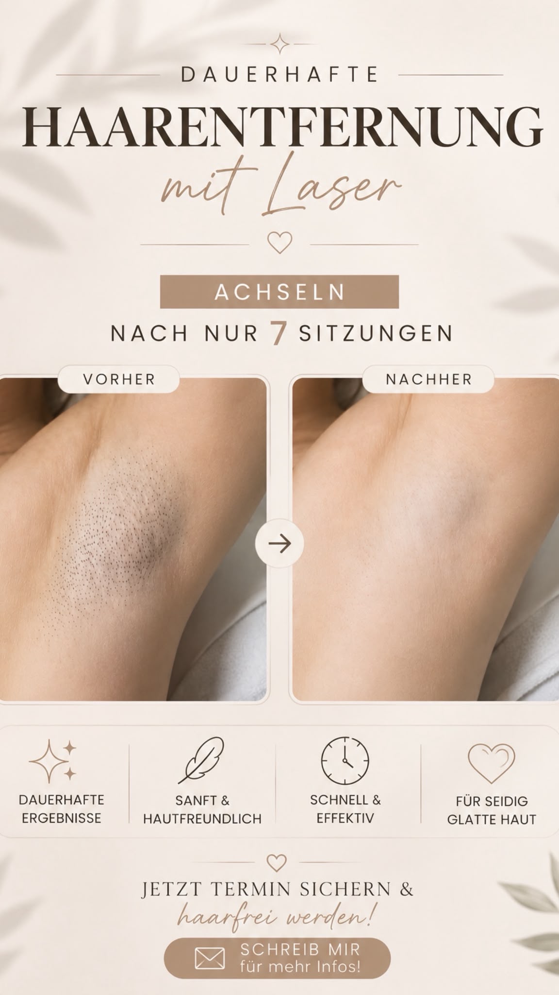 Dauerhafte Haarentfernung – Achseln, Vorher/Nachher nach 7 Sitzungen