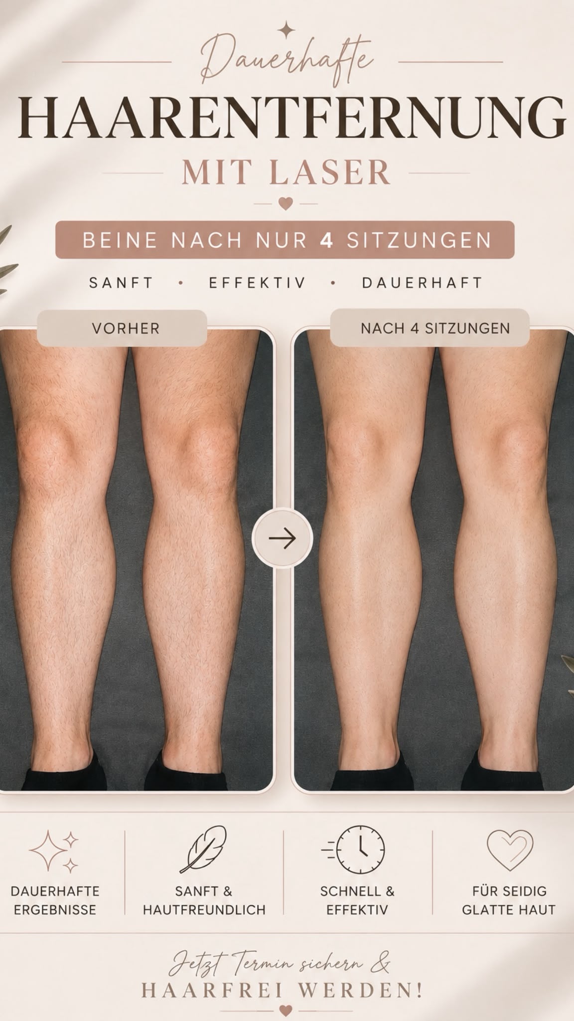 Dauerhafte Haarentfernung – Beine, Vorher/Nachher nach 4 Sitzungen